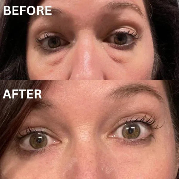 Patch istantanee rassodanti per gli occhi (8 paia)