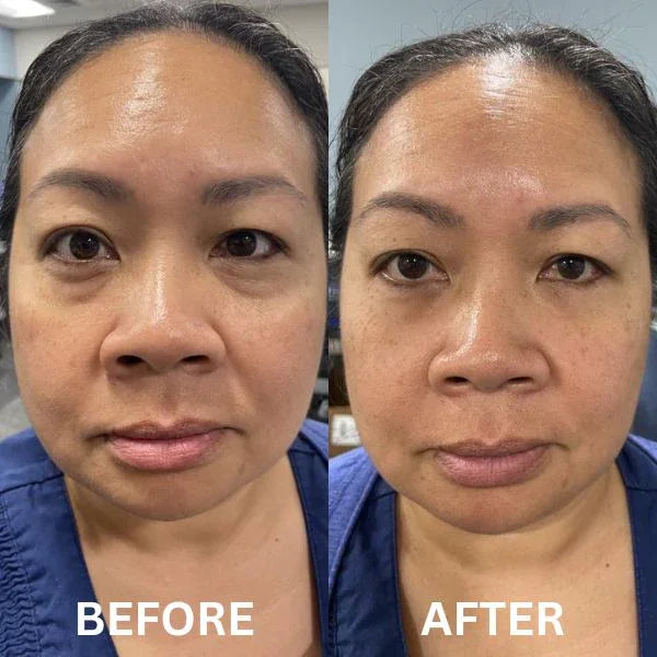 Patch istantanee rassodanti per gli occhi (8 paia)