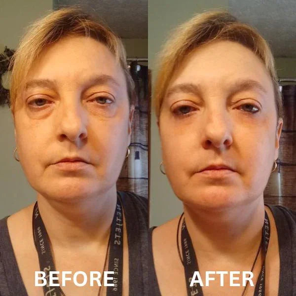 Patch istantanee rassodanti per gli occhi (8 paia)