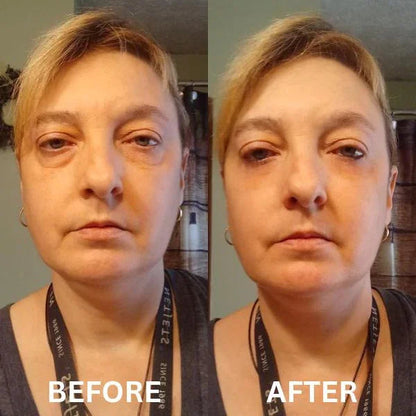 Patch istantanee rassodanti per gli occhi (8 paia)