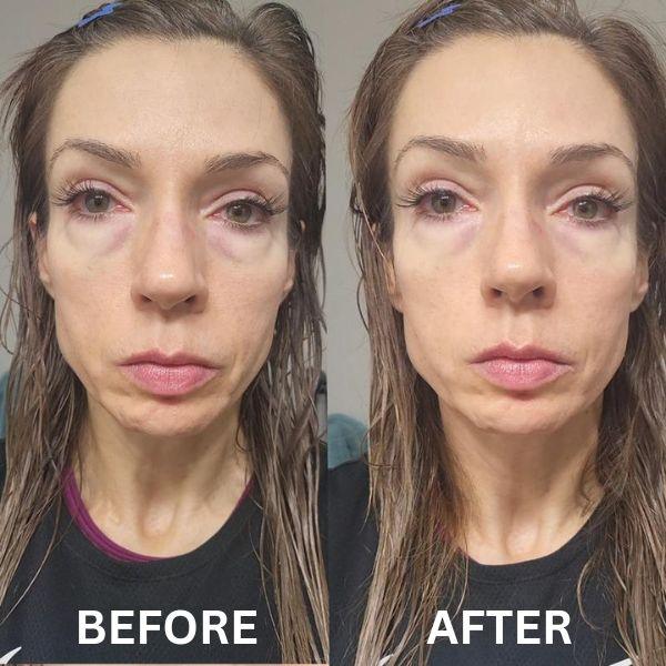 Patch istantanee rassodanti per gli occhi (8 paia)