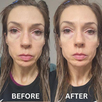 Patch istantanee rassodanti per gli occhi (8 paia)